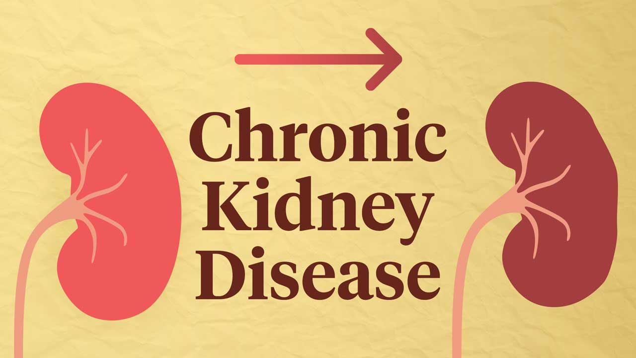 chronic-kidney-disease-treatment