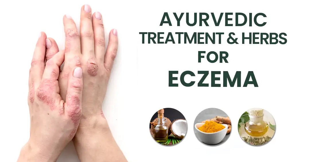Eczema Treatment In Ayurveda