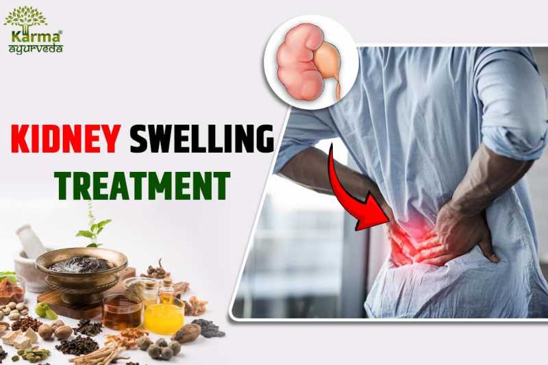 kidney-swelling-treatment
