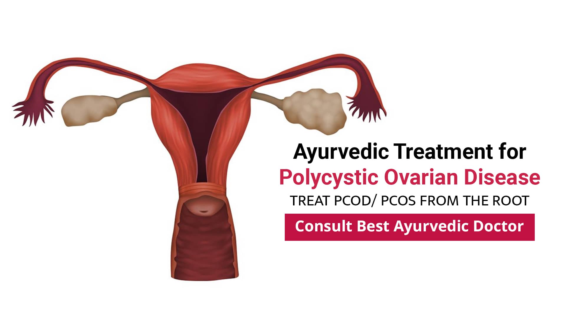 pcod-treatment-in-ayurveda