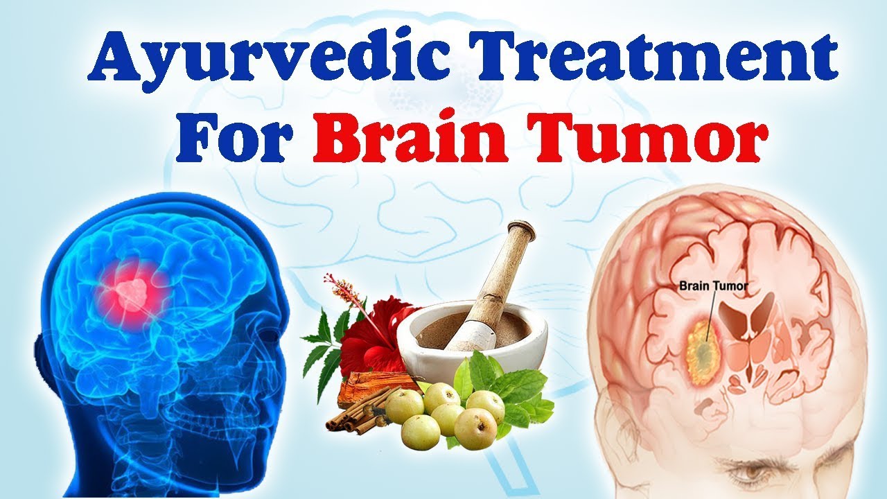 Treatment of Brain Cancer With Ayurvedic Remedies