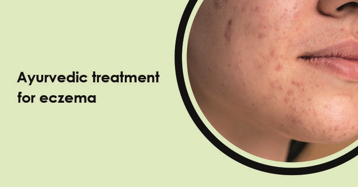 best-ayurvedic-medicine-for-eczema