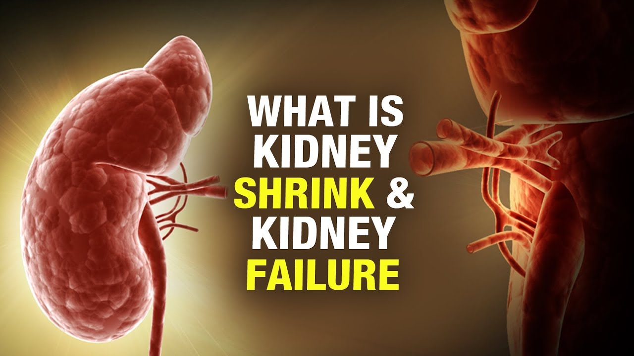 5 Best Kidney Shrinkage Medicines in Ayurveda