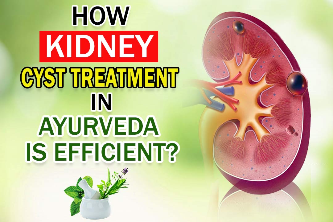 5 Best Kidney Cysts Disease Control Medicines in Ayurveda