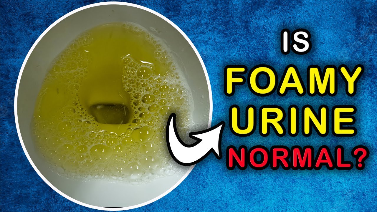 foamy-urine-control-medicines-in-ayurveda