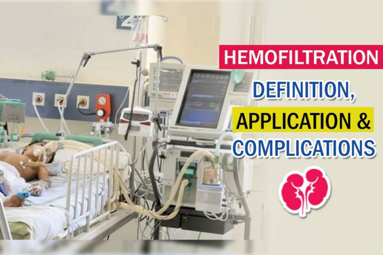 hemofiltration-definition-application-and-complications