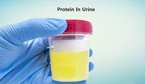 natural-ways-to-reverse-proteinuria