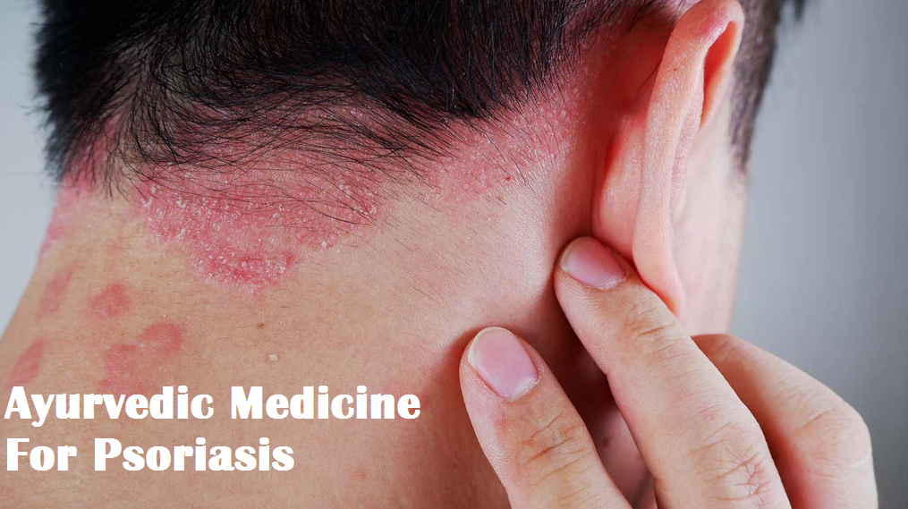 Ayurvedic Medicine for Psoriasis