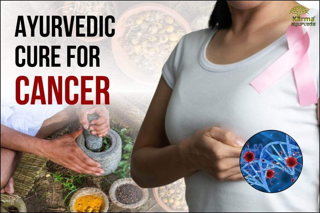 Cancer Ayurvedic Medicine