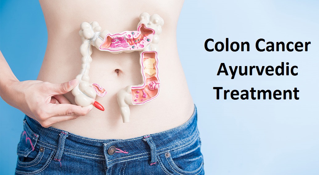 ayurveda-treatment-for-colon-cancer