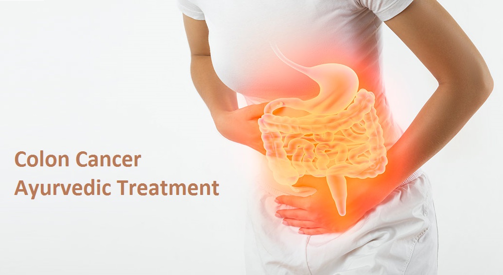 colon-cancer-ayurvedic-treatment