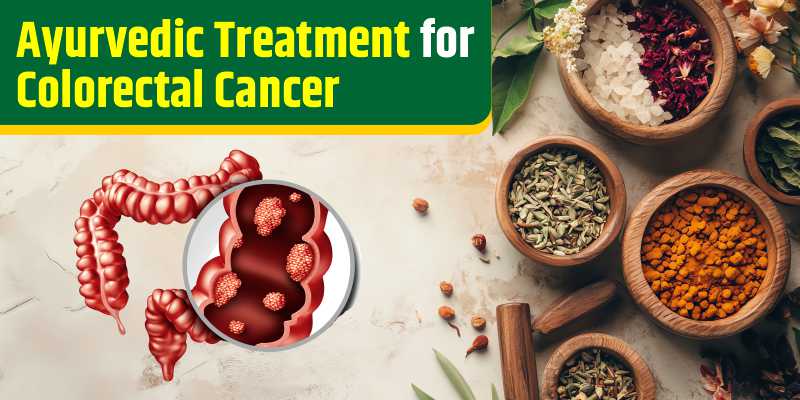 ayurvedic-treatment-for-colorectal-cancer