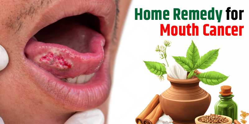 home-remedy-for-mouth-cancer