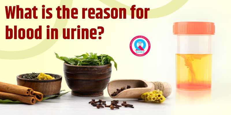 what-is-the-reason-for-blood-in-urine