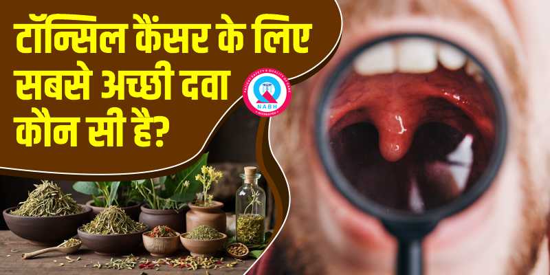 टॉन्सिल कैंसर के लिए सबसे अच्छी दवा कौन सी है?