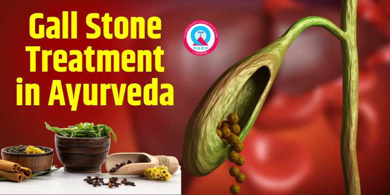 gall-stone-treatment-in-ayurveda