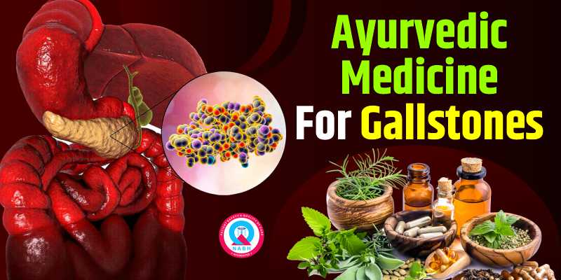 ayurvedic-medicine-for-gall-stones