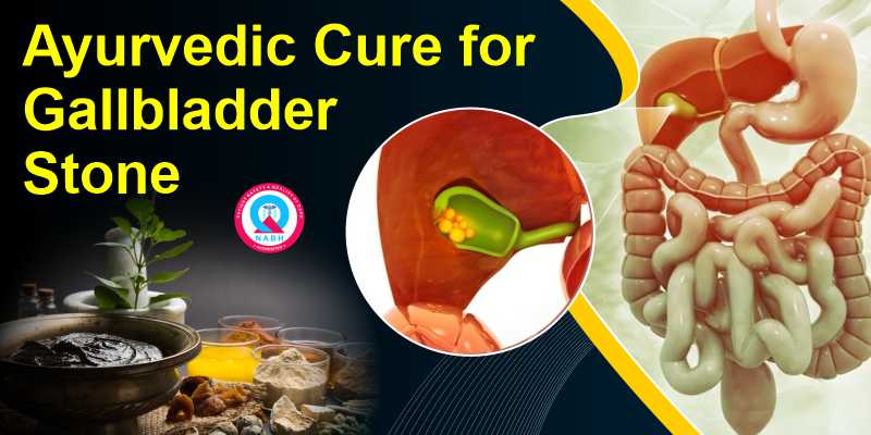 ayurvedic-cure-for-gallbladder-stone