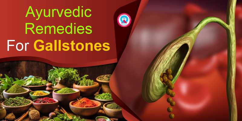 ayurvedic-remedies-for-gallstones