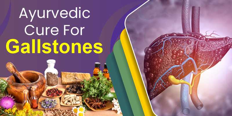 ayurvedic-cure-for-gallstones