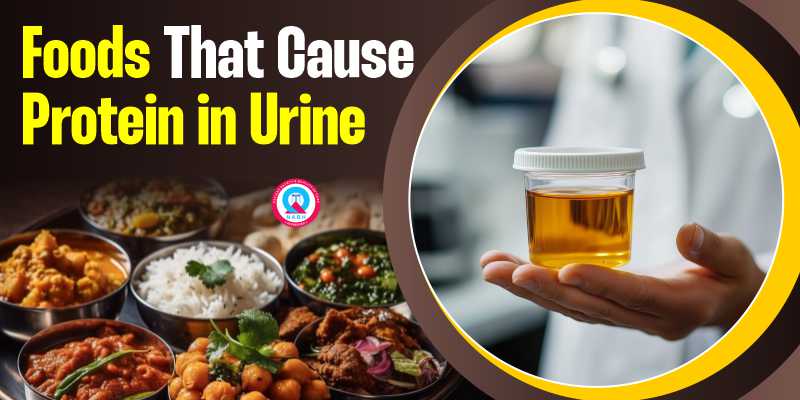 foods-that-cause-protein-in-urine